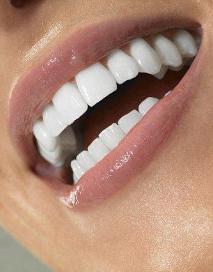 teeth whitening in Dubai