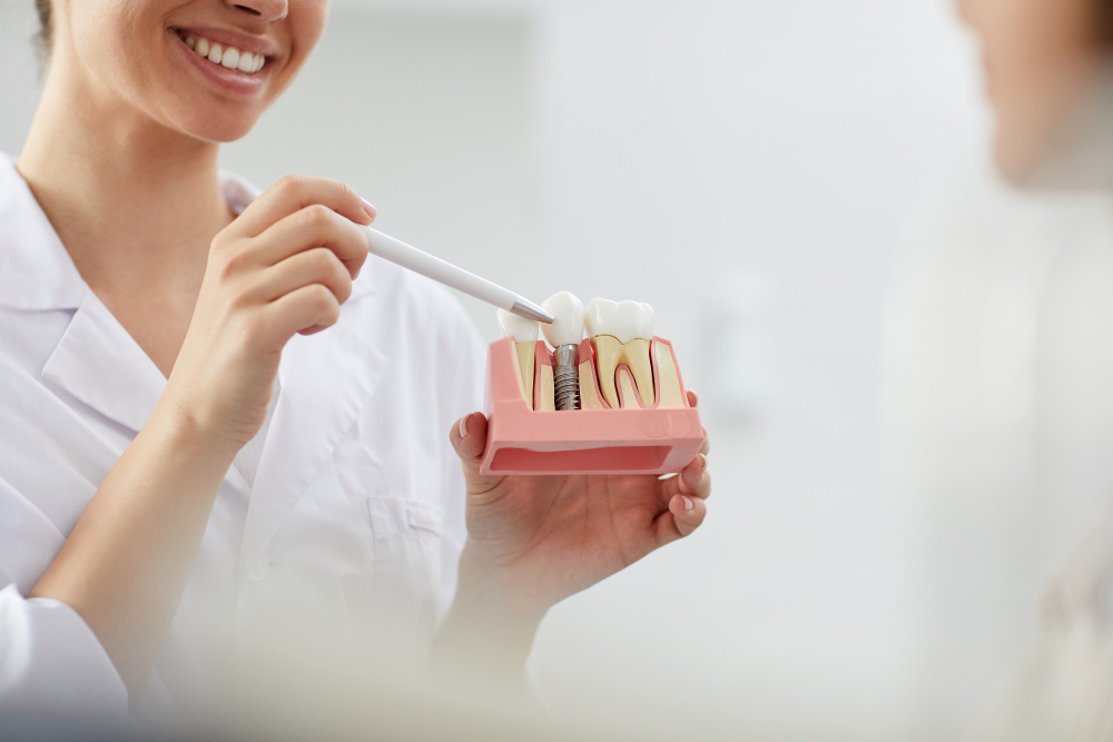 dental implants cost in sharjah
